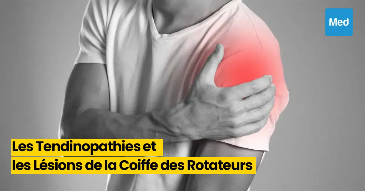 Comprendre et Gérer les Tendinopathies et les Lésions de la Coiffe des Rotateurs